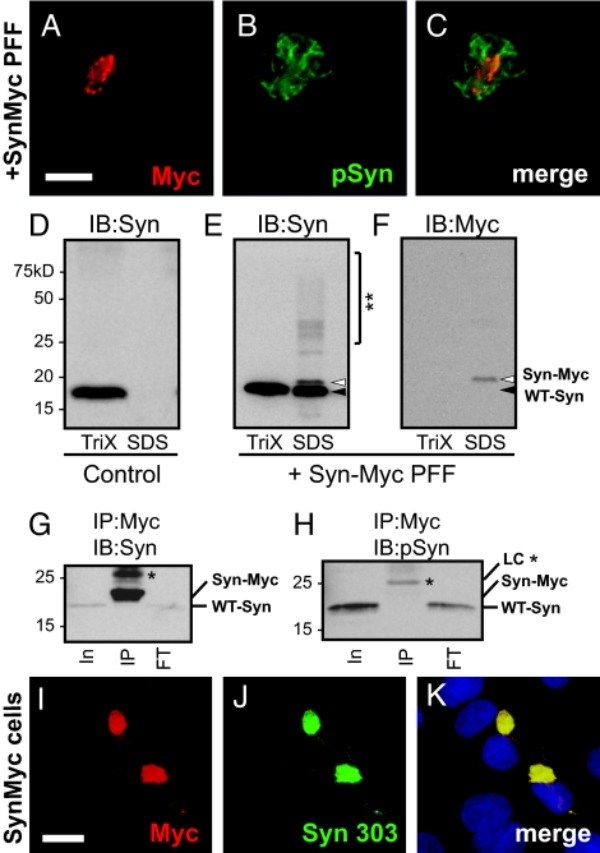 α-突触核蛋白细胞模型实验